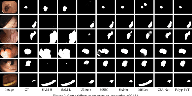 Figure 4 for Can SAM Segment Polyps?