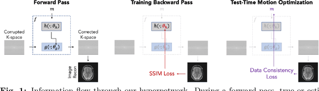 Figure 1 for Data Consistent Deep Rigid MRI Motion Correction