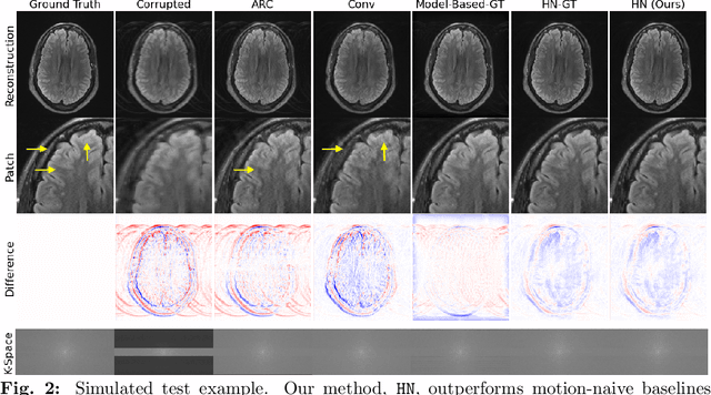 Figure 2 for Data Consistent Deep Rigid MRI Motion Correction