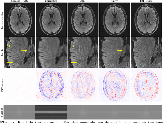 Figure 4 for Data Consistent Deep Rigid MRI Motion Correction