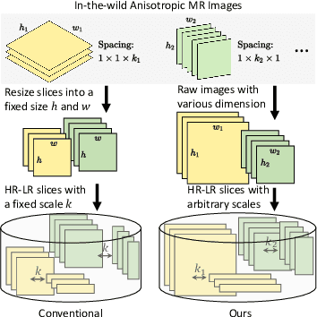 Figure 1 for Self-supervised arbitrary scale super-resolution framework for anisotropic MRI