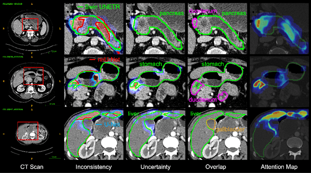 Figure 3 for Annotating 8,000 Abdominal CT Volumes for Multi-Organ Segmentation in Three Weeks