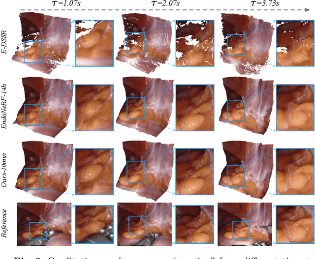 Figure 4 for Neural LerPlane Representations for Fast 4D Reconstruction of Deformable Tissues