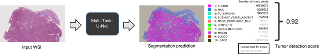Figure 1 for Multi-task learning for tissue segmentation and tumor detection in colorectal cancer histology slides