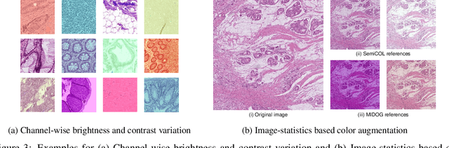 Figure 4 for Multi-task learning for tissue segmentation and tumor detection in colorectal cancer histology slides