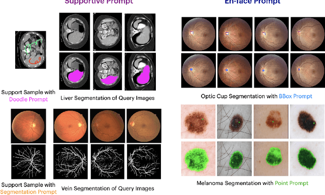 Figure 1 for PromptUNet: Toward Interactive Medical Image Segmentation