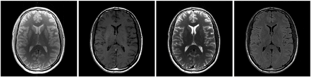 Figure 1 for Conditional Score-Based Reconstructions for Multi-contrast MRI