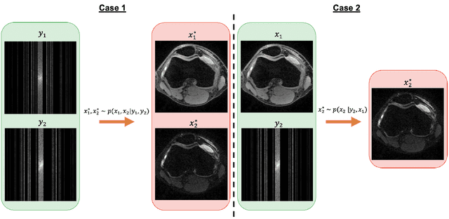 Figure 3 for Conditional Score-Based Reconstructions for Multi-contrast MRI