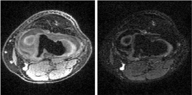 Figure 4 for Conditional Score-Based Reconstructions for Multi-contrast MRI