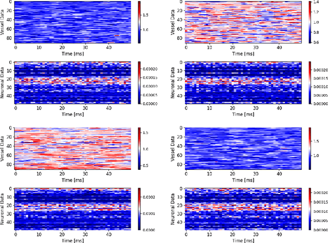 Figure 4 for Reconstructing the Hemodynamic Response Function via a Bimodal Transformer