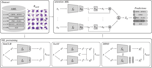 Figure 1 for Self-Supervised Multiple Instance Learning for Acute Myeloid Leukemia Classification