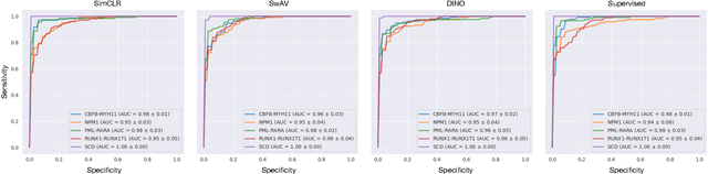 Figure 4 for Self-Supervised Multiple Instance Learning for Acute Myeloid Leukemia Classification