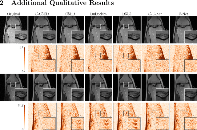 Figure 4 for Multi-scale MRI reconstruction via dilated ensemble networks