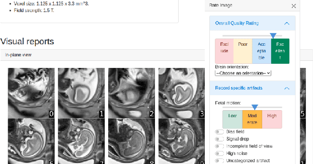 Figure 3 for FetMRQC: Automated Quality Control for fetal brain MRI