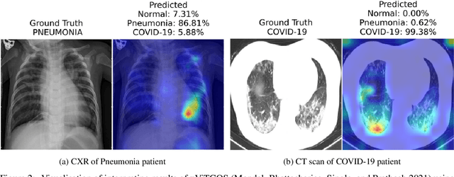 Figure 3 for Interpretable Medical Imagery Diagnosis with Self-Attentive Transformers: A Review of Explainable AI for Health Care
