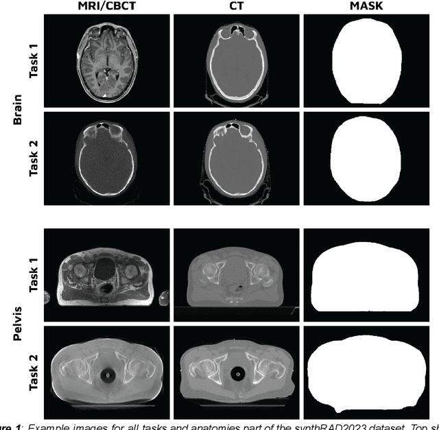 Figure 1 for SynthRAD2023 Grand Challenge dataset: generating synthetic CT for radiotherapy