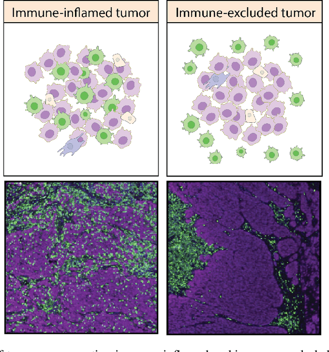 Figure 1 for Generating counterfactual explanations of tumor spatial proteomes to discover effective, combinatorial therapies that enhance cancer immunotherapy
