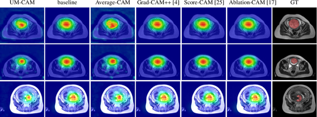 Figure 3 for UM-CAM: Uncertainty-weighted Multi-resolution Class Activation Maps for Weakly-supervised Fetal Brain Segmentation