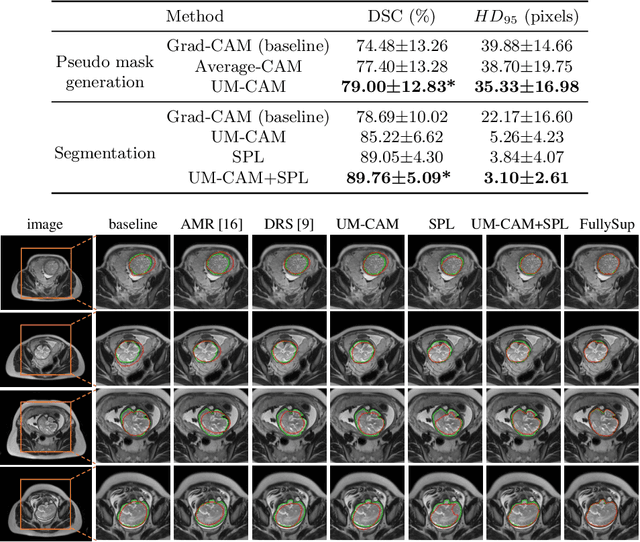 Figure 2 for UM-CAM: Uncertainty-weighted Multi-resolution Class Activation Maps for Weakly-supervised Fetal Brain Segmentation
