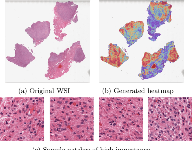 Figure 3 for Detecting Histologic Glioblastoma Regions of Prognostic Relevance