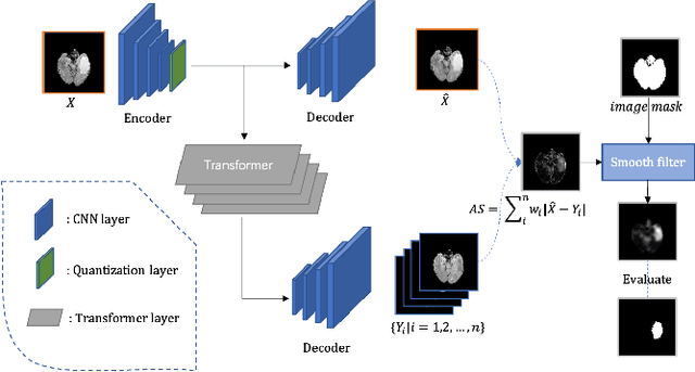 Figure 1 for Unsupervised Anomaly Detection with Local-Sensitive VQVAE and Global-Sensitive Transformers