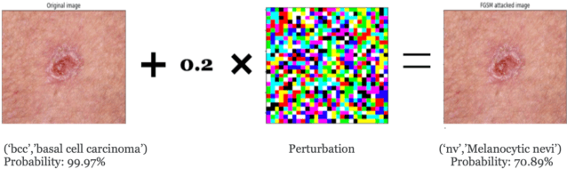 Figure 1 for Adversarial Attacks and Defences for Skin Cancer Classification