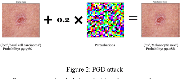 Figure 3 for Adversarial Attacks and Defences for Skin Cancer Classification