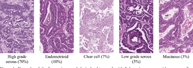 Figure 1 for Efficient subtyping of ovarian cancer histopathology whole slide images using active sampling in multiple instance learning