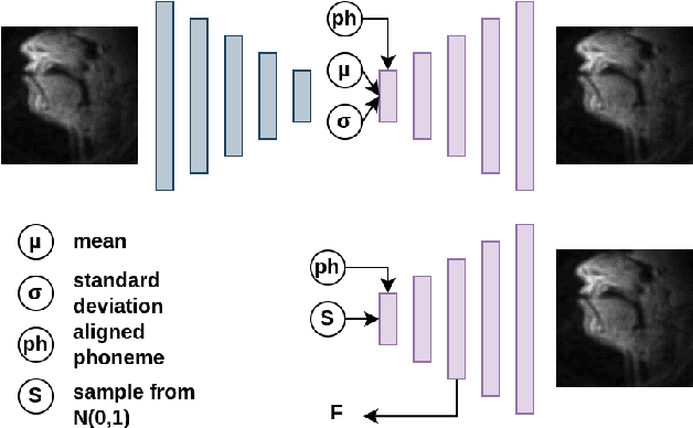 Figure 3 for Real-Time MRI Video synthesis from time aligned phonemes with sequence-to-sequence networks