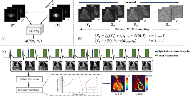 Figure 1 for Score-based Diffusion Models With Self-supervised Learning For Accelerated 3D Multi-contrast Cardiac Magnetic Resonance Imaging