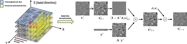 Figure 1 for Reference-Free Isotropic 3D EM Reconstruction using Diffusion Models
