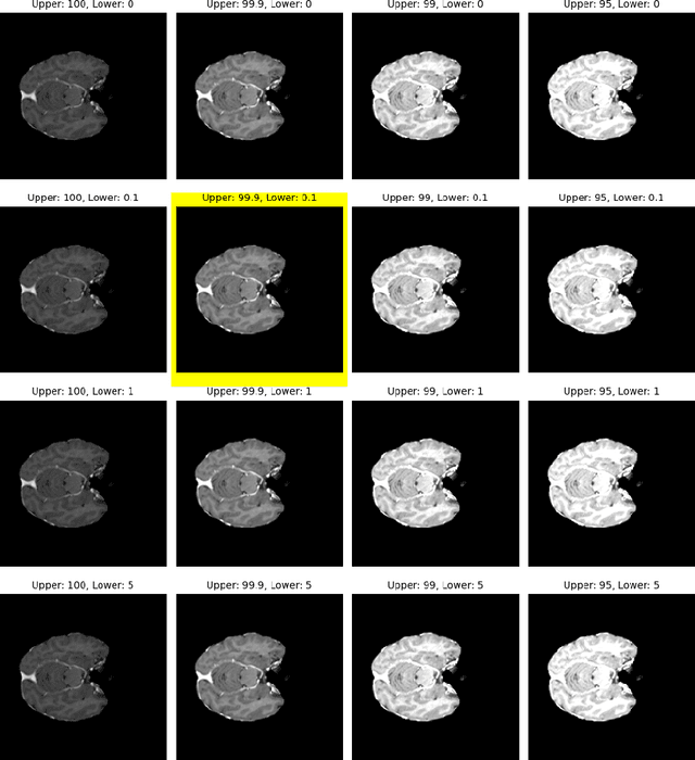 Figure 2 for All Sizes Matter: Improving Volumetric Brain Segmentation on Small Lesions