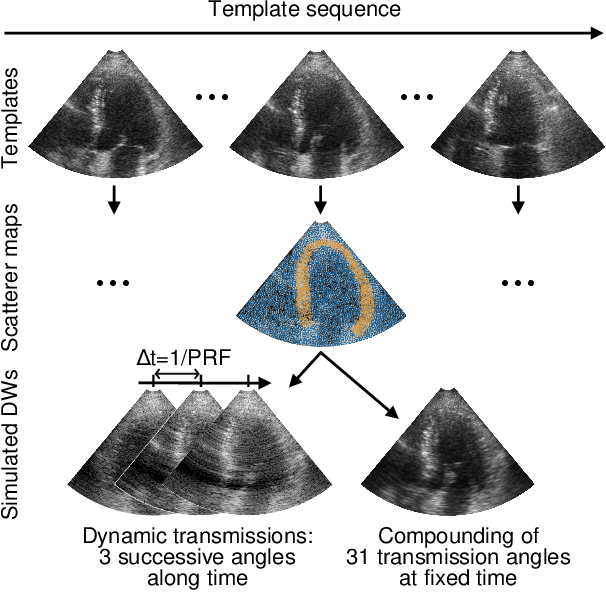 Figure 1 for Ultrafast Cardiac Imaging Using Deep Learning For Speckle-Tracking Echocardiography