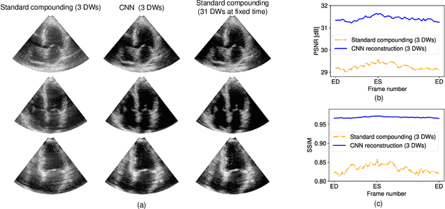 Figure 2 for Ultrafast Cardiac Imaging Using Deep Learning For Speckle-Tracking Echocardiography