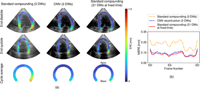 Figure 3 for Ultrafast Cardiac Imaging Using Deep Learning For Speckle-Tracking Echocardiography