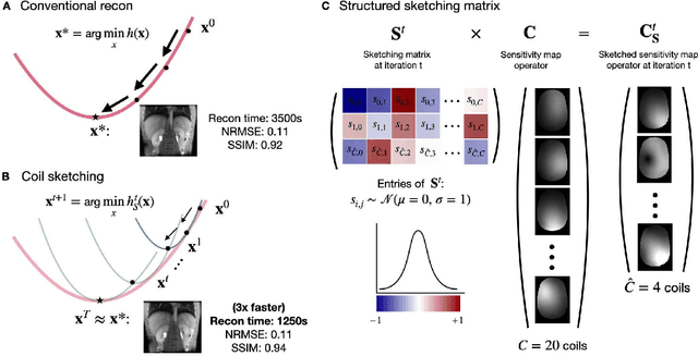 Figure 2 for Coil Sketching for computationally-efficient MR iterative reconstruction