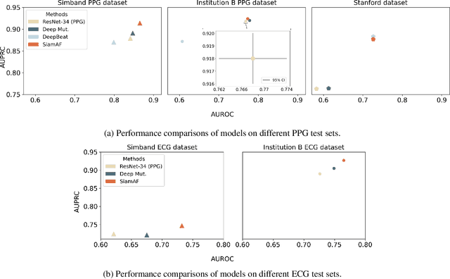 Figure 3 for SiamAF: Learning Shared Information from ECG and PPG Signals for Robust Atrial Fibrillation Detection
