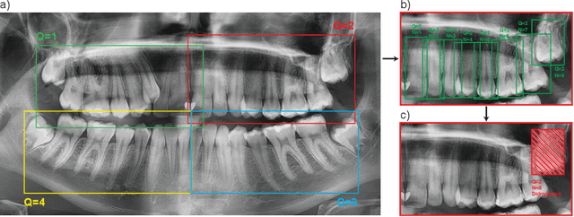 Figure 1 for Diffusion-Based Hierarchical Multi-Label Object Detection to Analyze Panoramic Dental X-rays