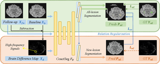 Figure 3 for CoactSeg: Learning from Heterogeneous Data for New Multiple Sclerosis Lesion Segmentation