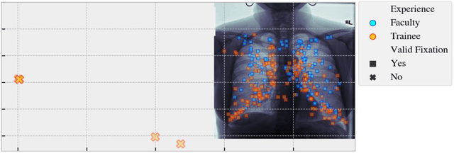 Figure 3 for Discrimination of Radiologists Utilizing Eye-Tracking Technology and Machine Learning: A Case Study