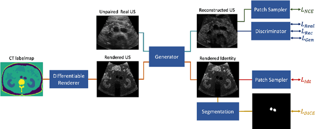 Figure 1 for LOTUS: Learning to Optimize Task-based US representations