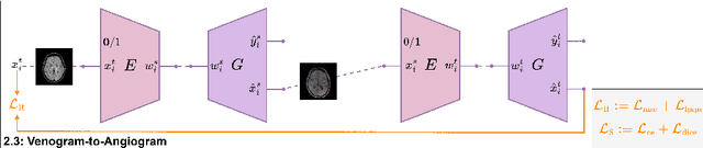 Figure 4 for A2V: A Semi-Supervised Domain Adaptation Framework for Brain Vessel Segmentation via Two-Phase Training Angiography-to-Venography Translation