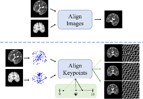 Figure 1 for A robust and interpretable deep learning framework for multi-modal registration via keypoints