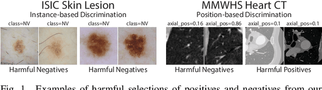 Figure 1 for Unsupervised Feature Clustering Improves Contrastive Representation Learning for Medical Image Segmentation