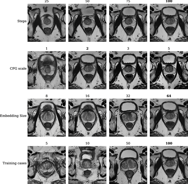 Figure 2 for Medical diffusion on a budget: textual inversion for medical image generation