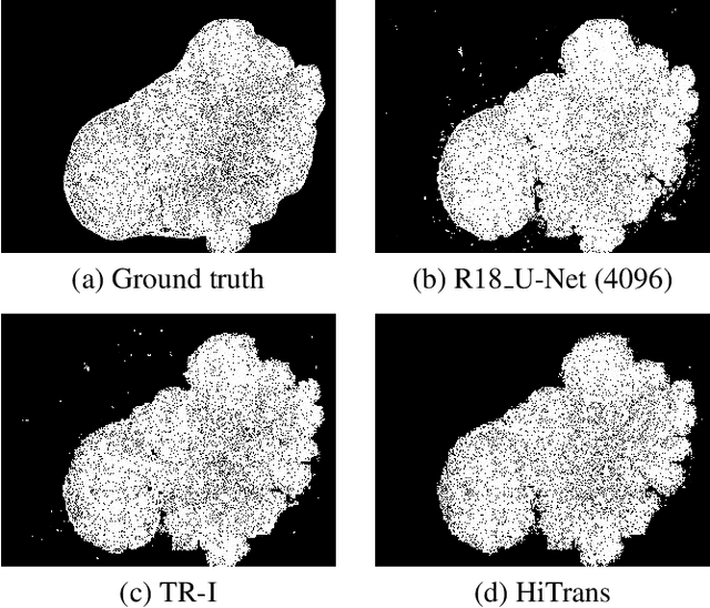 Figure 4 for A Hierarchical Transformer Encoder to Improve Entire Neoplasm Segmentation on Whole Slide Image of Hepatocellular Carcinoma