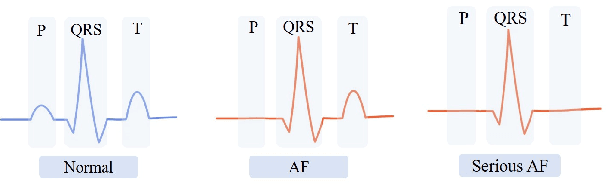 Figure 3 for A Deep Learning Method for Beat-Level Risk Analysis and Interpretation of Atrial Fibrillation Patients during Sinus Rhythm