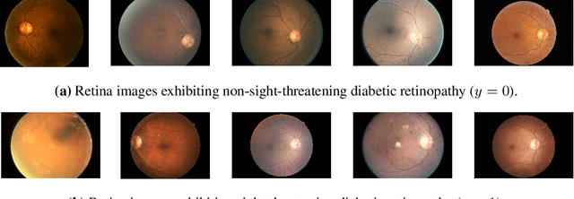 Figure 1 for Benchmarking Bayesian Deep Learning on Diabetic Retinopathy Detection Tasks