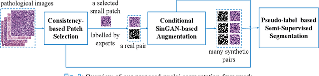 Figure 2 for Which Pixel to Annotate: a Label-Efficient Nuclei Segmentation Framework
