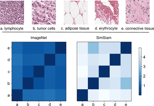 Figure 1 for The Whole Pathological Slide Classification via Weakly Supervised Learning